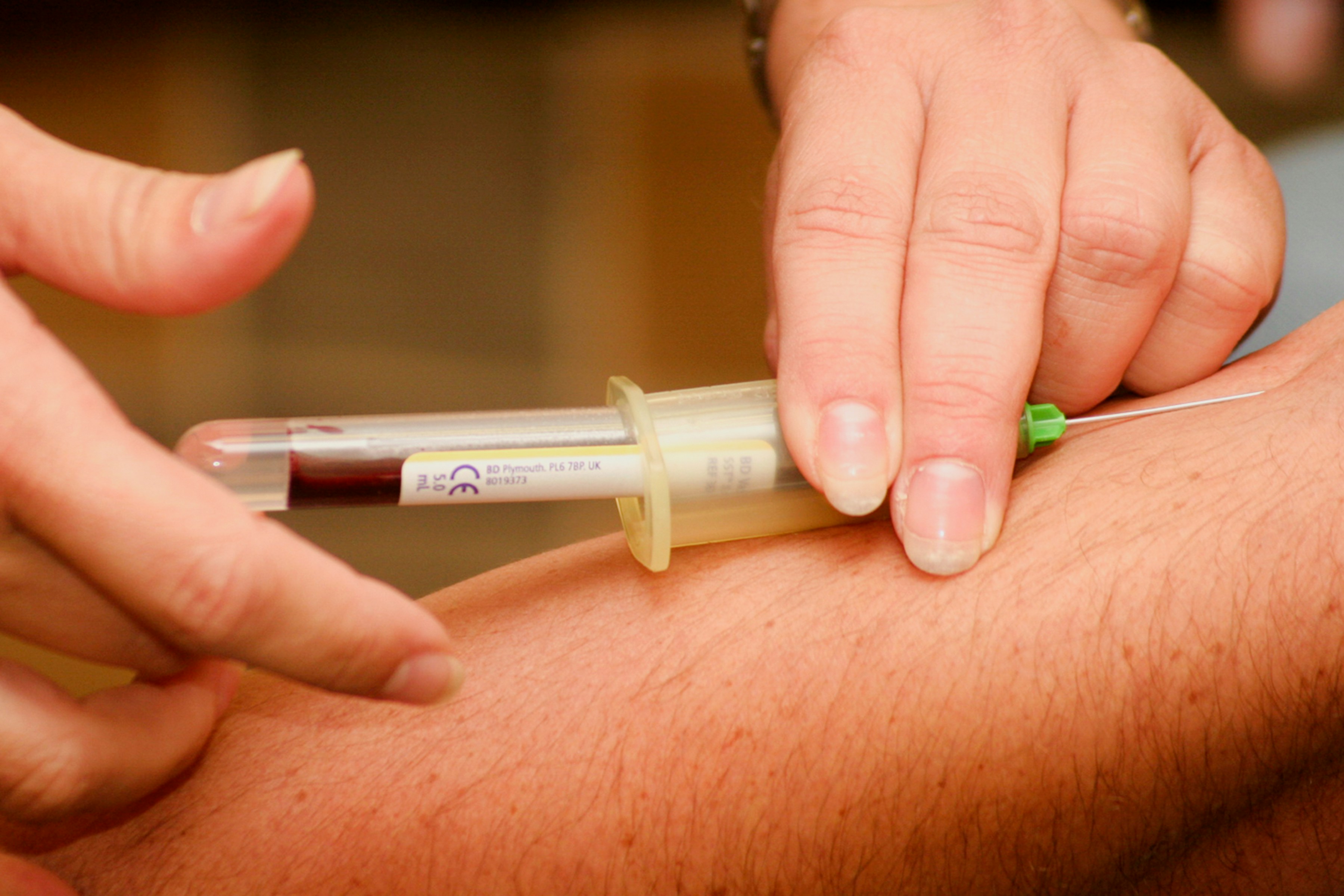 Blutentnahme: Füllung einer Vakuette am Arm des Patienten